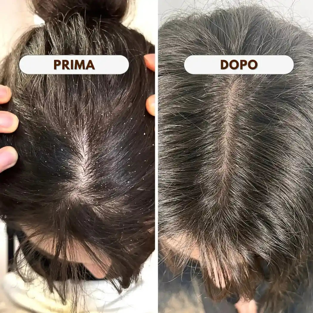 PURÌ - Shampoo Purificante Cute con Forfora