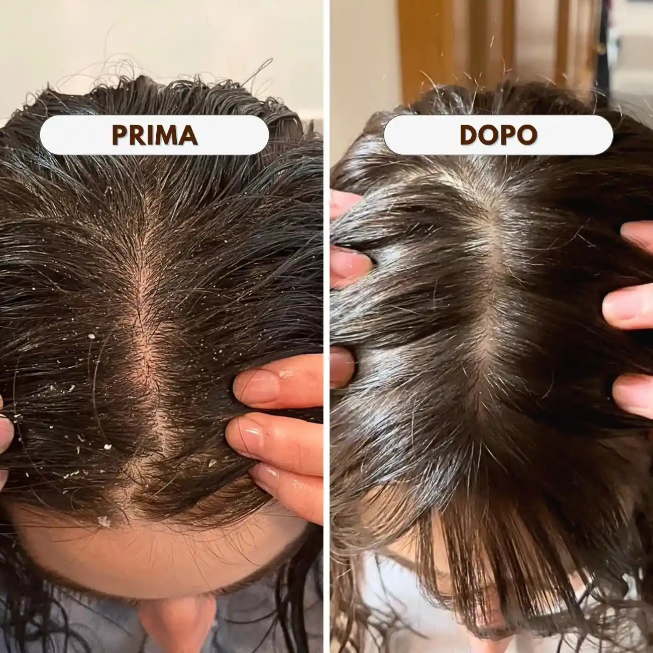 PURIFY OIL - Olio Purificante Antiforfora Riequilibrante