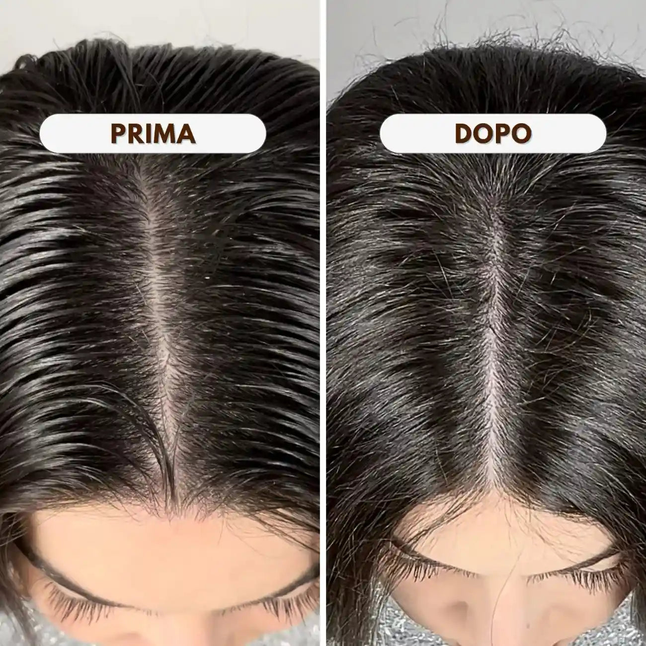 Kit cute grassa Completo - il tuo sistema riequilibrante in 2 step