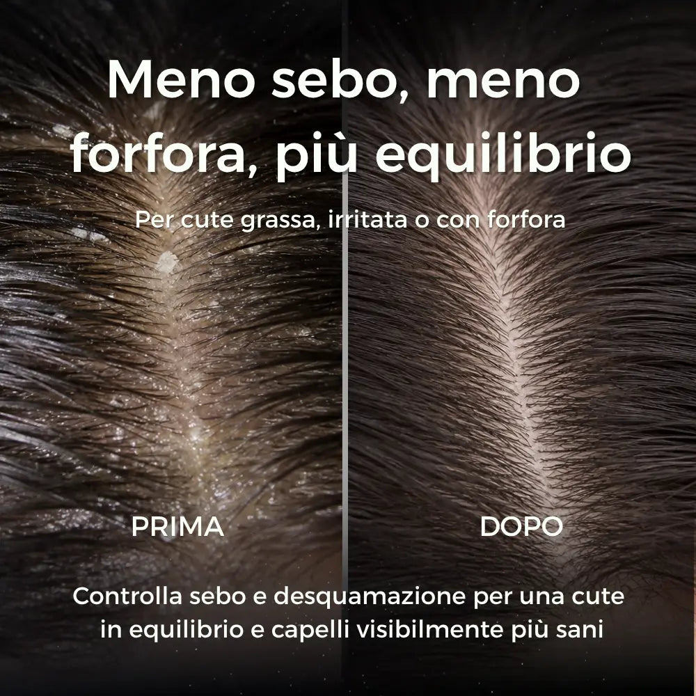 Purifyoil peeling antiforfora riequilibrante cute grassa