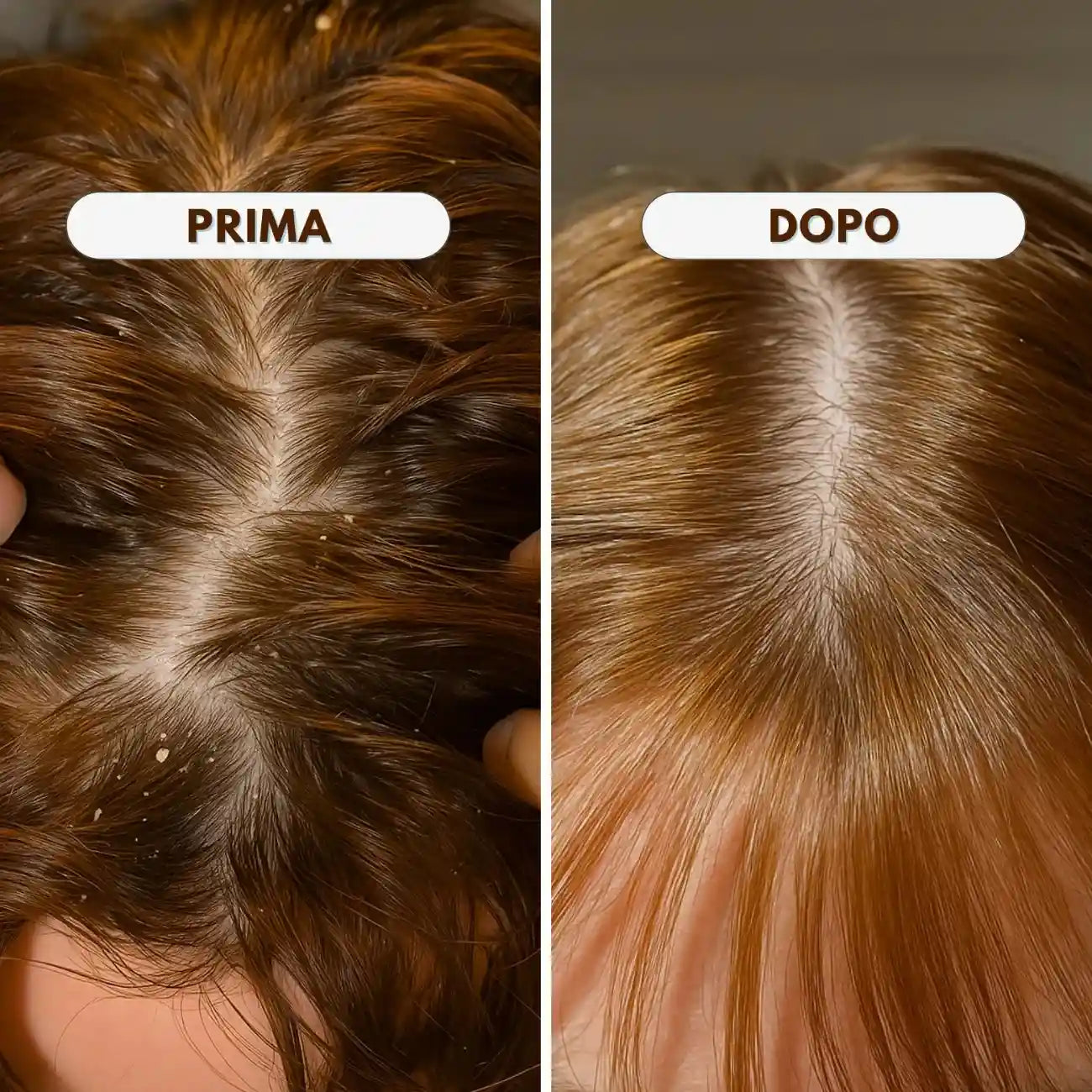 PURIFY OIL - Olio Purificante Antiforfora Riequilibrante