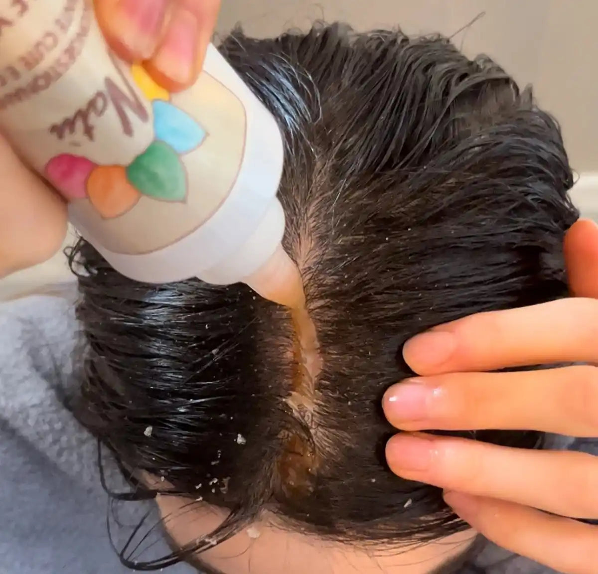 Kit Antiforfora Completo -  il tuo sistema antiforfora in 2 step