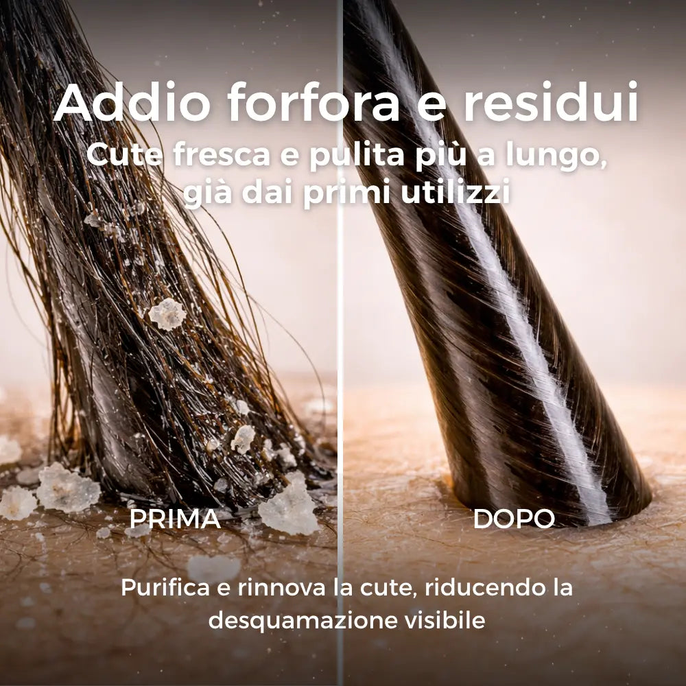 PURIFY OIL - Olio Peeling Purificante Anti Impurità & Riequilibrante