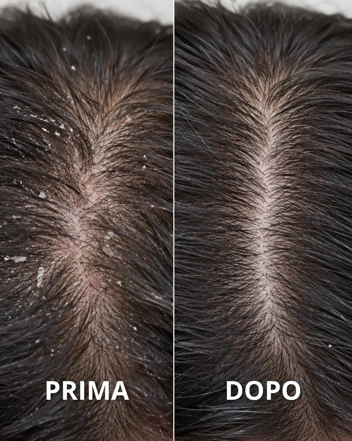 PURÌ - Shampoo Purificante Antiforfora Antibatterico - immagine 6