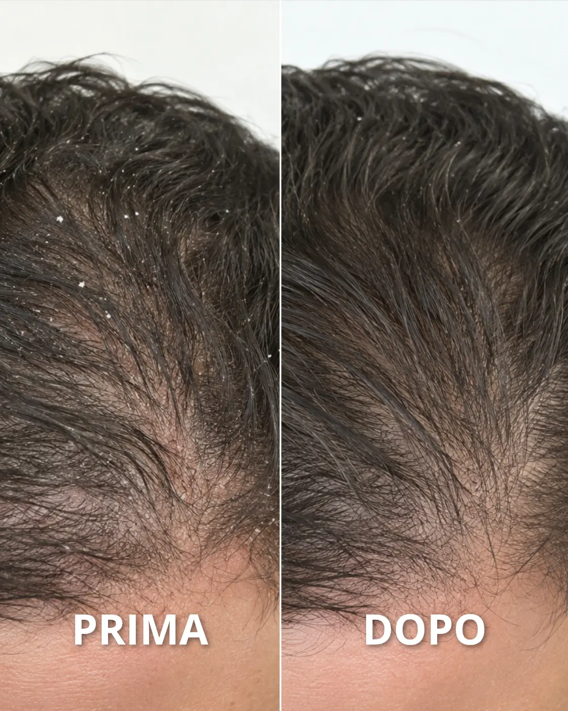 PURÌ - Shampoo Purificante Antiforfora Antibatterico - immagine 5