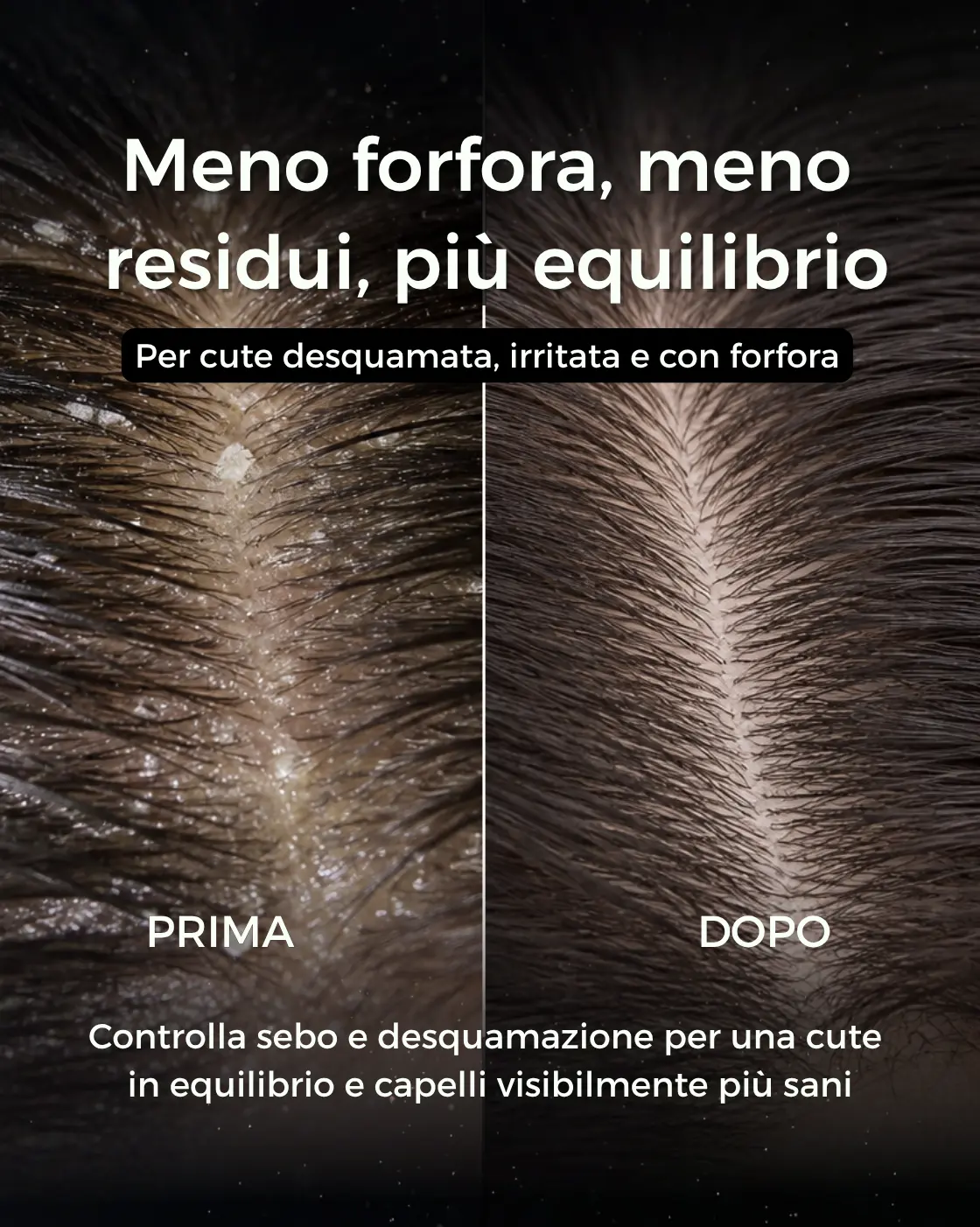 PURÌ - Shampoo Purificante Antiforfora Antibatterico - immagine 4