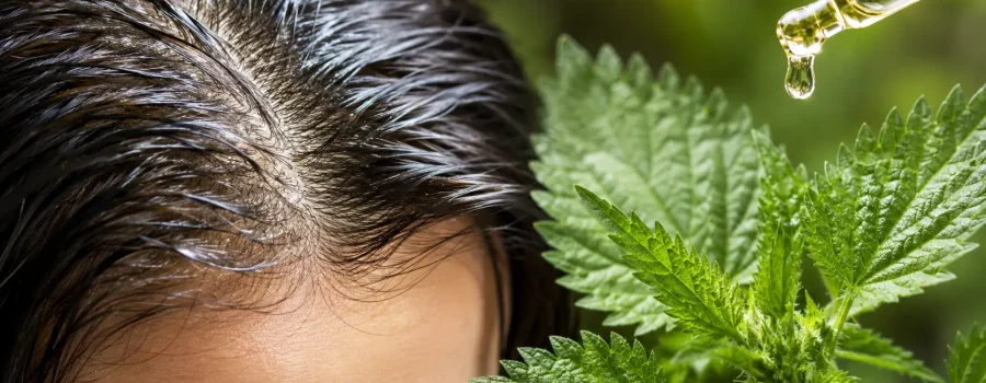 ortica per capelli grassi benefici e migliore shampoo naturale. Olio rimedio naturale capelli grassi
