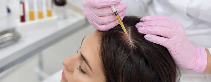 Trattamento PRP capelli per contrastare la perdita di capelli e il diradamento, con infiltrazioni di plasma ricco di piastrine sul cuoio capelluto per stimolare i follicoli e favorire la crescita dei capelli.